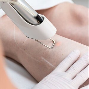 Huidzorg Laserklinieken Eindhoven- Best image 2